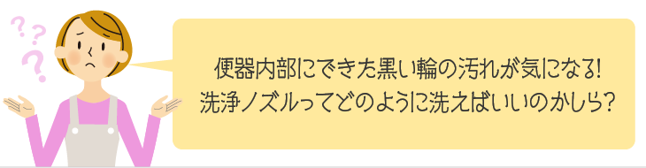 便器内部にできた黒い輪の汚れが気になる!洗浄ノズルってどのように洗えばいいのかしら?